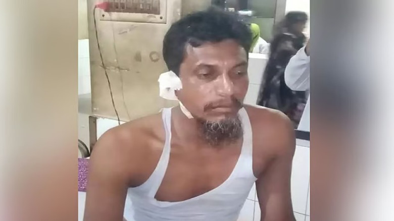 সিগারেট না পেয়ে দোকানির কান কামড়ে ছিঁড়ে ফেলল যুবক!...