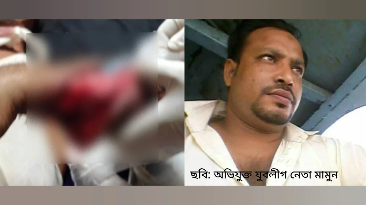 তুচ্ছ ঘটনাকে কেন্দ্র করে রায়পুরে বিএনপি কর্মীকে কু...