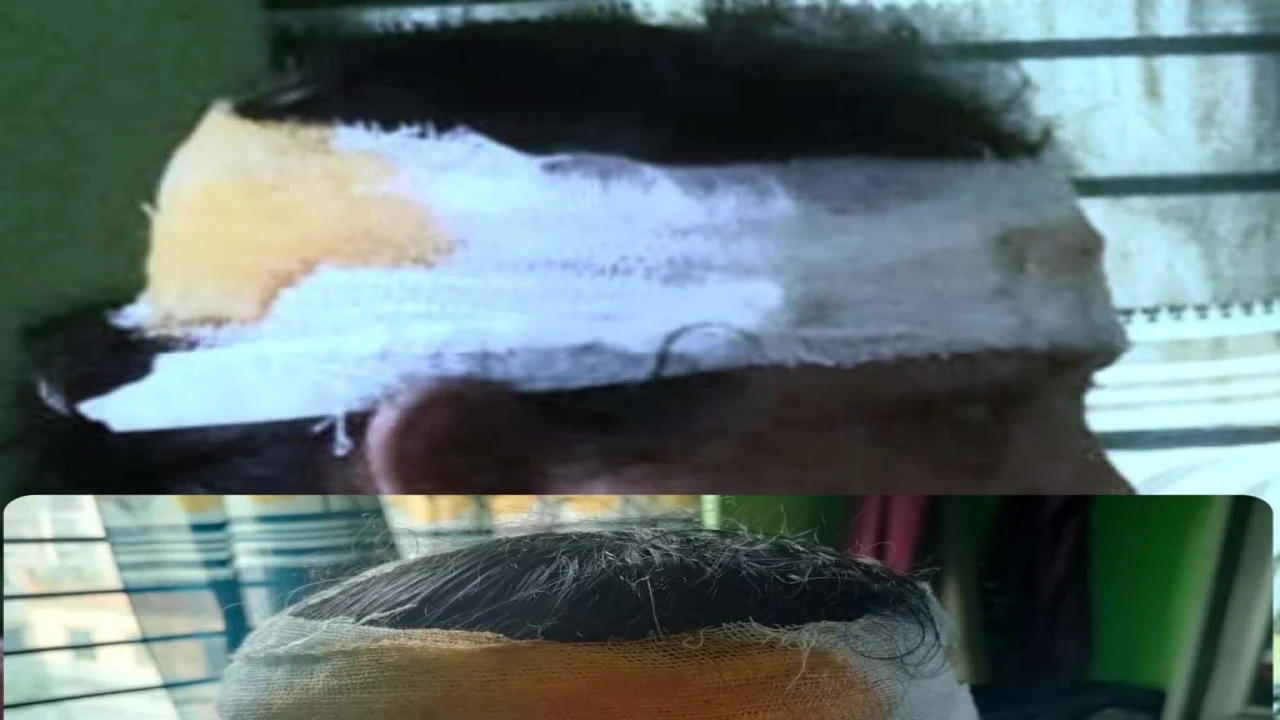 গণসংযোগকালে জামায়াত নেত্রীকে কুপিয়ে জখম করার ঘটনায়...