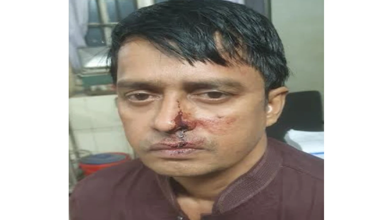 সাংবাদিকের ওপর সন্ত্রাসী হামলা ...