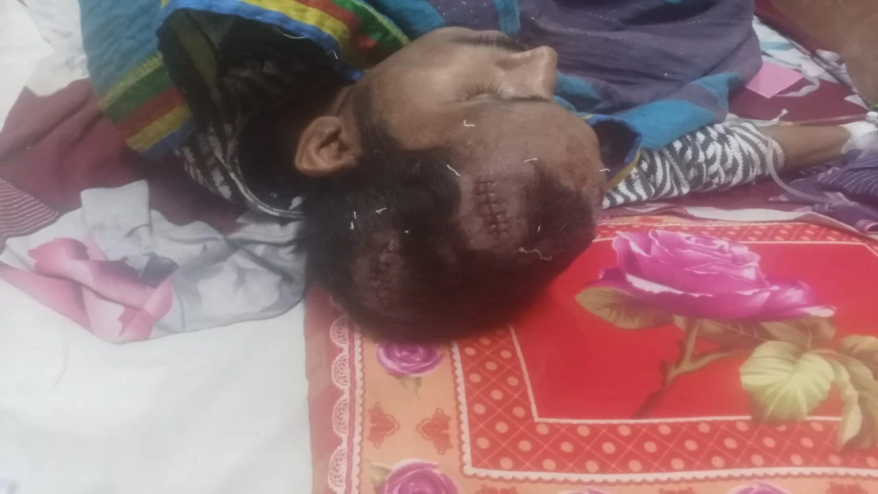 রংপুরে ঘরে ঢুকে লোহার রড দিয়ে যুবককে হামলা, আতঙ্কে ভুক্তভোগী পরিবার 