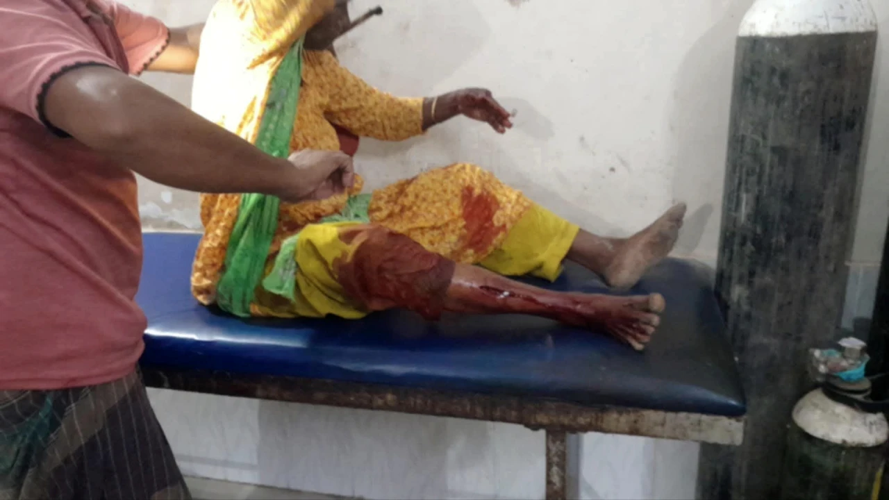 ঠাকুরগাঁওয়ে হায়না সদৃশ বন্য প্রাণীর হামলা, আহত ১০
